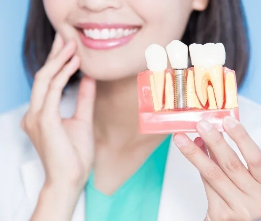 Benefits of Dental Implants-img