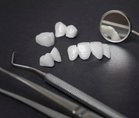 Metal-Free Dental Restorations-img