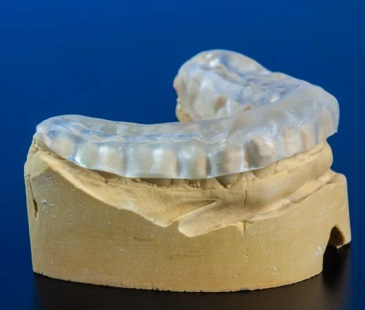 Nightguards for Bruxism-img