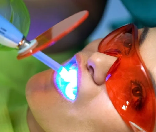 Teeth Whitening-img
