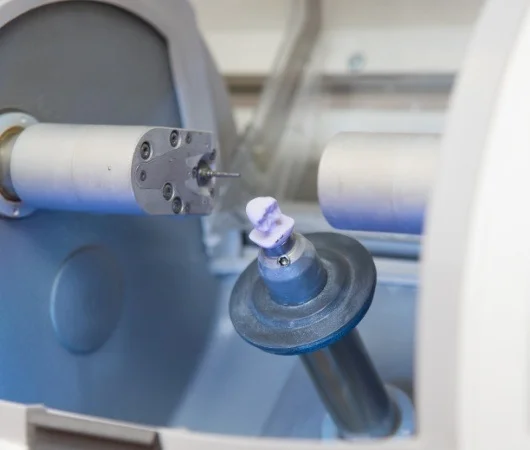 The Process of Getting a CEREC Same-Day Dental Crown-img