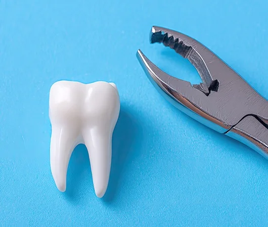 The Process of Removing a Tooth-img