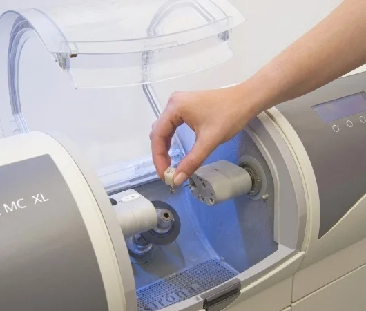 What Are CEREC Same-Day Dental Crowns-img