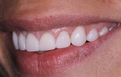 smile-gallery-a-10