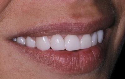 smile-gallery-a-11