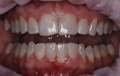 smile-gallery-a-8