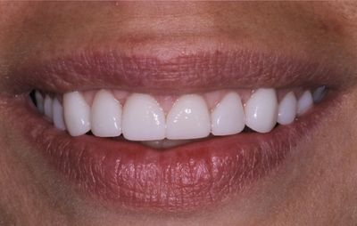 smile-gallery-a-9
