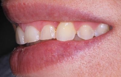 smile-gallery-b-10