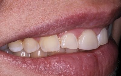 smile-gallery-b-11