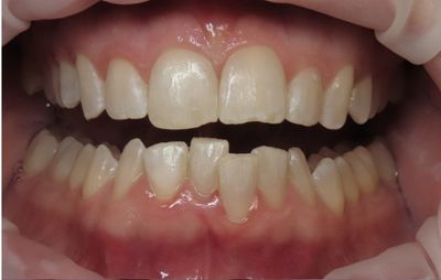 smile-gallery-b-8