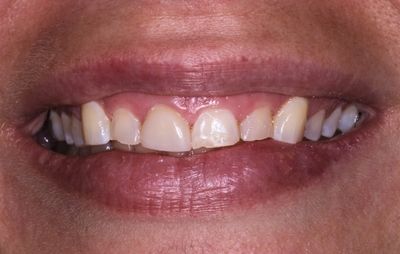 smile-gallery-b-9